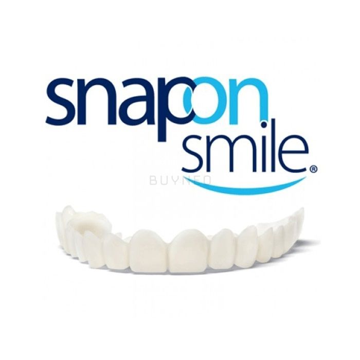 Snap-On Smile ⏤ veneer